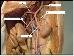 a) celiac
b) superior mesenteric
c) renal artery
d) dorsal aorta
e) adrenolumbar artery