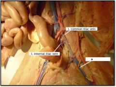 a) l. femoral vein