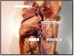 a) inferior vena cava
b) renal vein