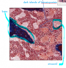 bone trabeculae make pockets for the developing immune cells. 
The dark regions: islands of hematopoiesis where they're developing
The lighter regions: sinusoids where the cells go, making their way to the central sinus