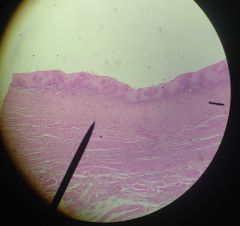 What tissue is this?