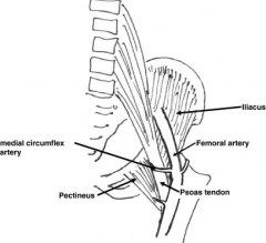 Weinstein and Ponseti suggested that the anteromedial approach provides "a safe, effective way to reduce a dislocated hip in infancy". The superficial plane is between gracilis and adductor longus. The deep plane is between adductor brevis and add...