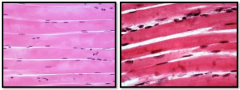 IMAGE voluntary in function and generally associated with visible body movements 

Long, cylindrical, unbranched cells with striations and multiple nuclei per cell