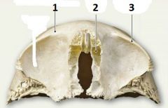 Frontal Bone - Inferior view