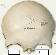 Frontal Bone -  Anterior