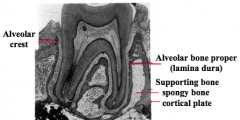 Lamina dura is the alveolar bone lining the tooth socket and is where the pdl inserts

They all meet at alveolar crest