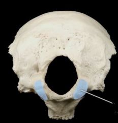  Inferior view


(Occipital)