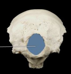 Inferior view (Occipital)
