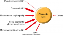 *Crescentic GN, FSGS, MPGN are the big 3, but anything can lead to it.