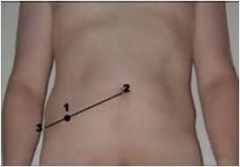 Midpoint between anterior superior iliac spine (ASIS) and umbilicus.

Deep palpation at McBurney’s point reproducing pain = positive McBurney’s sign 
- suggests appendicitis