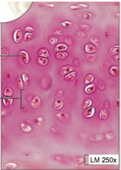 semisolid matrix containing chondrocytes