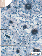 calcified matrix containing osteocytes
