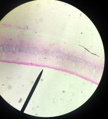 What Tissue is this?
