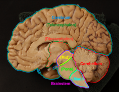 -cerebrum
-cerebellum
-brainstem (midbrain, pons, medulla)