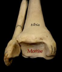- Ankle joint


 


- distal tibia & fibula, & talus


 


- "ankle mortise"


 


- surrounded by an articular capsule


 


- ligamentous support


 


- dorsiflexion & plantarflexion