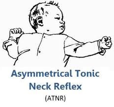 The Tonic neck Reflex, occurs in the 1st 4 to 6 weeks.  When you rotate head and hold for 5 seconds, like the "fencing" posture the forward UE extends while the back one flexes.  This promotes visual hand regard.