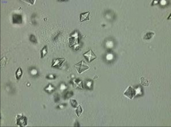 Calcium oxalate stones. Look like envelopes.