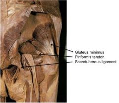 In Figure A, the arrow labeled A is pointing to the Gluteus minimus muscle, B is pointing to the tendon of the piriformis muscle, and C is pointing to the sacrotuberous ligament (Illustration A). These are all important landmarks and points of ide...
