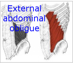 External abdominal oblique