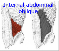 Internal abdominal oblique
