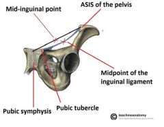 Mid-inguinal point 
