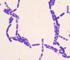 Bacillus cereus
