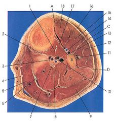 when performing a posterior lateral tibia


 what is the 2 compartments between
what is to nervous plane between
 name 18 structures on this cross-section