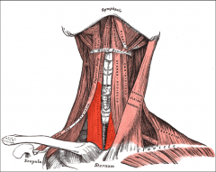 thyroid cartilage