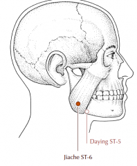 Approximately 1 fingerbreadth anterior and superior to the angle of the jaw at the prominence of the masseter muscle.