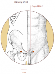 On the lower abdomen, 2 cun lateral to the midline, level with the superior border of the symphysis pubis.