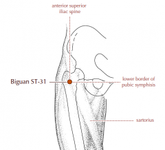 On the upper thigh, in a depression just lateral to the sartorius muscle, at the junction of a vertical line drawn downward from the anterior superior iliac spine, and a horizontal line drawn level with the lower border of the pubic symphysis.