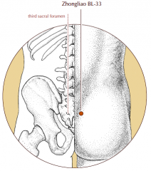 Over the third posterior sacral foramen.