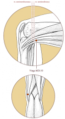At the medial end of the popliteal crease, between the semitendinosus and semimembranosus tendons.  Locate and needle with the knee slightly flexed.