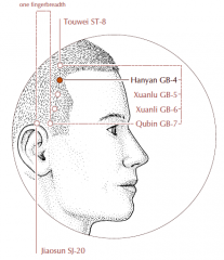 In the temporal region, within the hairline, one quarter of the distance between St-8 and GB-7.