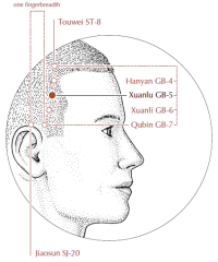 In the temporal region, within the hairline, half the distance between St-8 and GB-7.