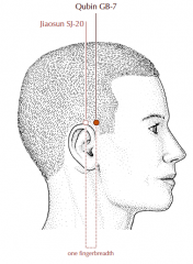 In the temporal region, within the hairline, level with and one fingerbreadth anterior to SJ-20.