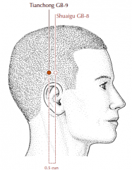 Above the ear, in the depression 0.5 cun posterior to GB-8.