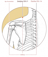 Midway between Du-14 and the tip of the acromion, at the crest of the trapezius muscle.