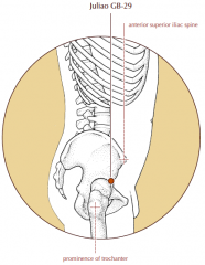 On the lateral aspect of the hip joint, at the midpoint of a line drawn between the anterior superior iliac spine and the prominence of the greater trochanter.