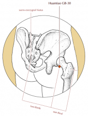 On the postero-lateral aspect of the hip joint, one third of the distance between the prominence of the greater trochanter and the sacro-coccygeal hiatus.