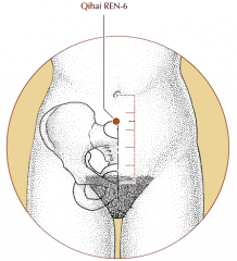 On the midline of the lower abdomen, 1.5 cun inferior to the umbilicus and 3.5 cun superior to the pubic symphysis.