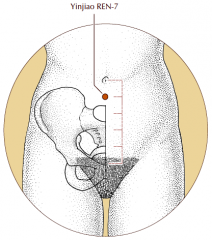 On the midline of the lower abdomen, 1 cun inferior to the umbilicus and 4 cun superior to the pubic symphysis.