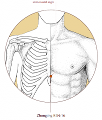 On the midline of the sternum at the sternocostal angle.