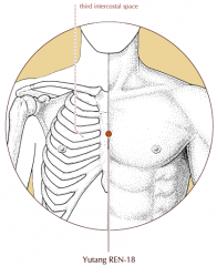 On the midline of the sternum, level with the junction of the 3rd intercostal space and the sternum.