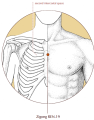 On the midline of the sternum, level with the junction of the 2nd intercostal space and the sternum.