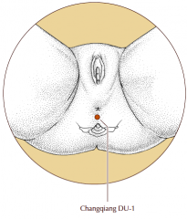 On the midline, midway between the tip of the coccyx and the anus.