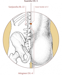 On the midline of the lower back, in the depression below the spinous process of the first lumbar vertebra.