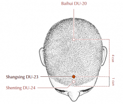 At the top of the head on the midline, 1 cun posterior to the anterior hairline and 0.5 cun posterior to Du-24.