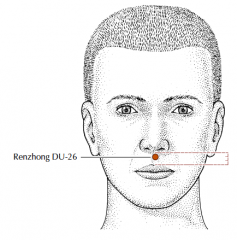 Above the upper lip on the midline, at the junction of the upper third and lower two thirds of the philtrum.