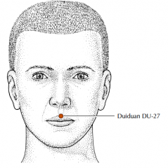On the midline, at the junction of the margin of the upper lip and the philtrum.
